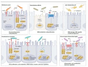 Pathogenic Gut Bacteria in Cancer Initiation
