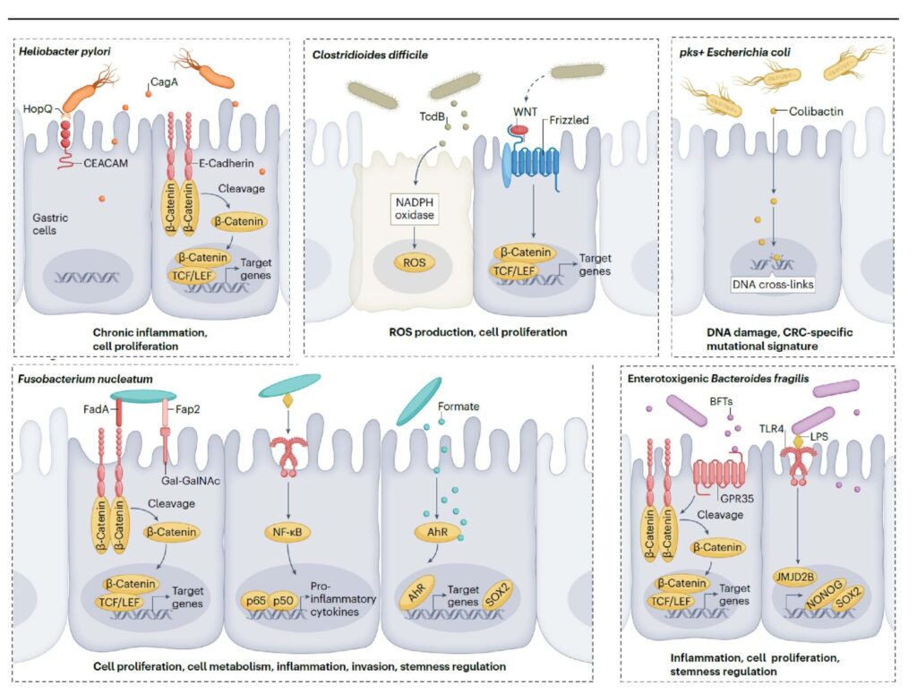 The Hidden Role of Pathogenic Gut Bacteria in Cancer Initiation & How Carciclear IgY Offers a New Line of Defense